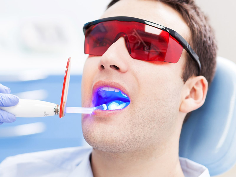 laserterapia dentale dentista emilia